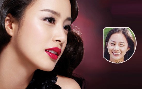 Hàm răng của Kim Tae Hee cũng đẹp hơn rất nhiều. Xem thêm:Môi xinh nồng nàn, quyến rũ như Sao Hàn trên tạp chí