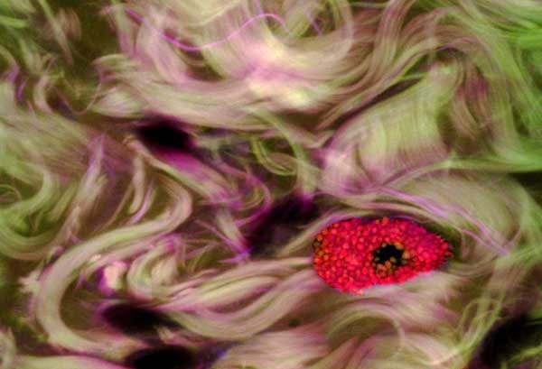 Vi khuẩn đơn bào Mast trong mắt người bị viêm kết mạc. Bức hình của Donald Pottle, Viện nghiên cứu Mắt Schepens ở Boston, Massachusetts, Mỹ.