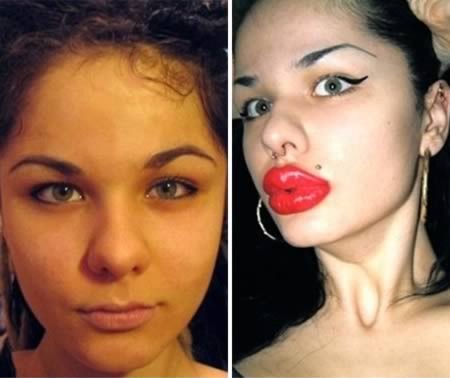 Cô gái Nga bơm môi hơn 100 lần: Người phụ nữ tuyệt vọng này đã được công nhận là người có đôi môi lớn nhất thế giới sau hơn 100 lần bơm môi.