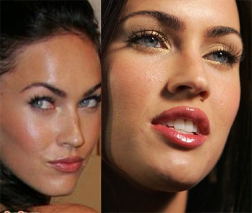 Megan Fox liên tục bị phát hiện đi bơm môi.