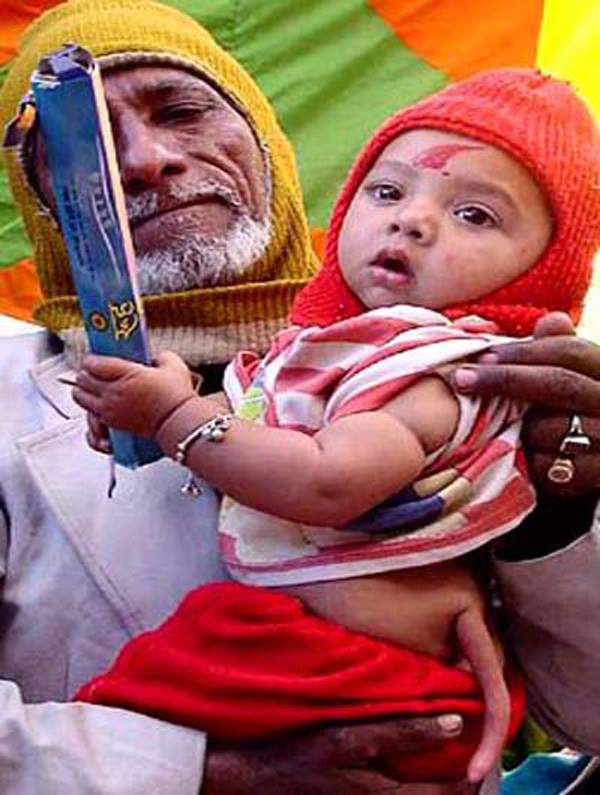 Cậu bé người Ấn Độ vừa sinh ra đã có một chiếc đuôi. Nhiều người tin rằng, cậu bé là con của một vị thần Hindu tái sinh và người ta đặt cho cậu cái tên Hunamam- tên của một vị thần.