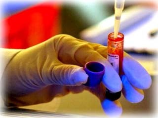 Xét nghiệm máu: Nhiều dấu hiệu tiểu đường rất thầm lặng. Nhưng một xét nghiệm máu đơn giản có thể tiết lộ mức độ nguy cơ của bạn. Hãy kiểm tra định kỳ để phát hiện bệnh sớm, trước khi quá muộn.