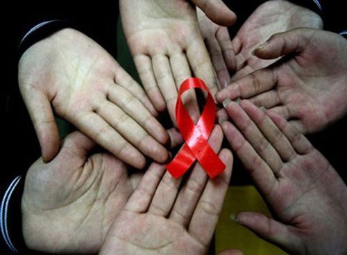 HIV và AIDS được các bác sĩ điều trị theo phác đồ khác nhau mặc dù chúng có cùng một nguồn gốc do virus HIV gây ra.