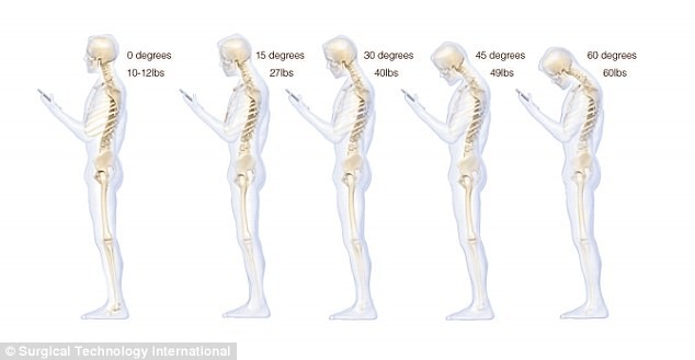 Áp lực lên xương cổ và cách sử dụng điện thoại