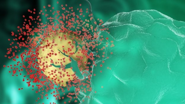 Virus HIV màu đỏ đã bị nhiễm một tế bào màu vàng trong hệ thống miễn dịch