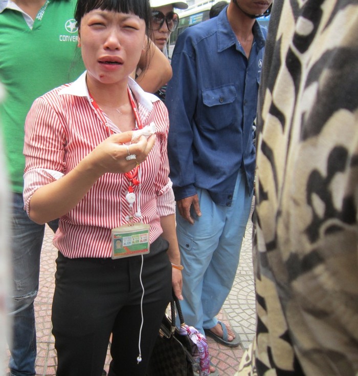Chị Nguyễn Thị Thu Phương tố bị tài xế xe buýt 54 hành hung chảy máu mồm, mặt mũi sưng húp.
