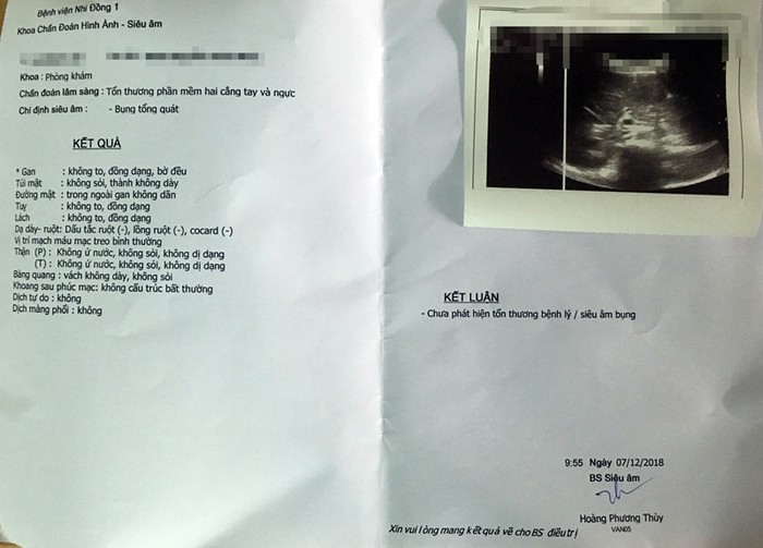 Kết quả siêu âm cháu bé khi đưa đi khám nghiệm tại Bệnh viện Nhi Đồng. (Ảnh: Gia đình nạn nhân cung cấp)
