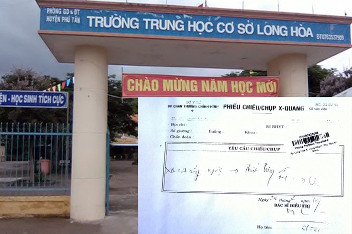 Trường Trung học cơ sở Long Hòa và phiếu yêu cầu chụp X-Quang của phụ huynh tại bệnh viện. (Ảnh: H.L)
