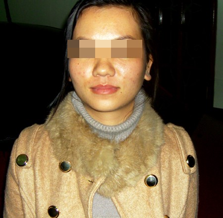Chị gái nạn nhân kể về bà chủ bắt osin xăm rết lên mặt ảnh 1