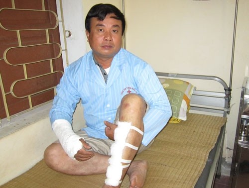 Trước đó, ngày 19/6, anh Cường cũng bị quái xế tông gãy tay và bị thương ở chân.
