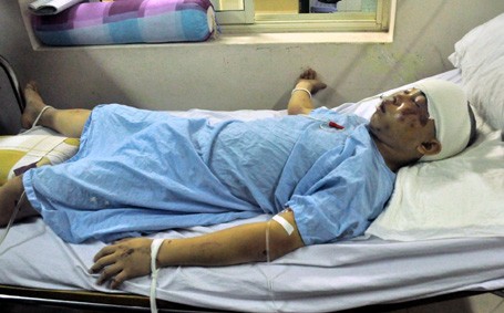 Thiếu úy Lâm đang được điều trị tại bệnh viện trong tình trạng nguy kịch. Ảnh: Dân trí