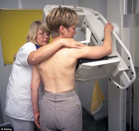 Số bệnh nhân đòi bác sỹ làm phẫu thuật cắt bỏ bộ ngực giống Angelina Jolie tăng gấp 4 lần