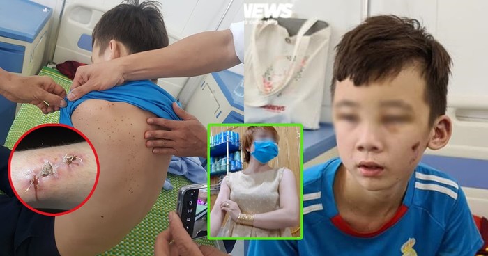 Bé trai bị bạo hành ở Bắc Ninh. Ảnh tổng hợp từ VTC News
