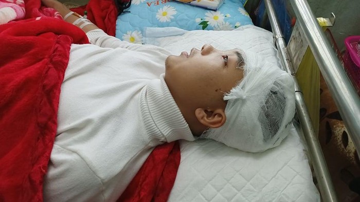 Em Phan Thanh L. bị đánh vỡ sọ não đang được điều trị tại Bệnh viện Đa khoa tỉnh Thanh Hóa. Ảnh: Gia đình cung cấp