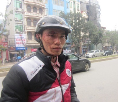 Anh Kim Văn Chung sau khi bị lái, phụ xe hành hung