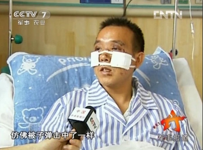 Phi công 1, huấn luyện viên Trương Kiến Hưng bị thương do vỡ kính khoang lái máy bay ở độ cao 3000 m