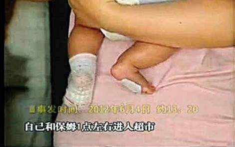 Con trai chị Châu mới hơn 2 tháng tuổi khi bế ra siêu thị mua đồ cho bé thì bị rạch gót