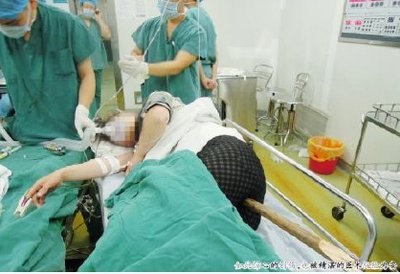 Chị Cao bị chiếc gậy xuyên dọc người khi được đưa đến bệnh viện