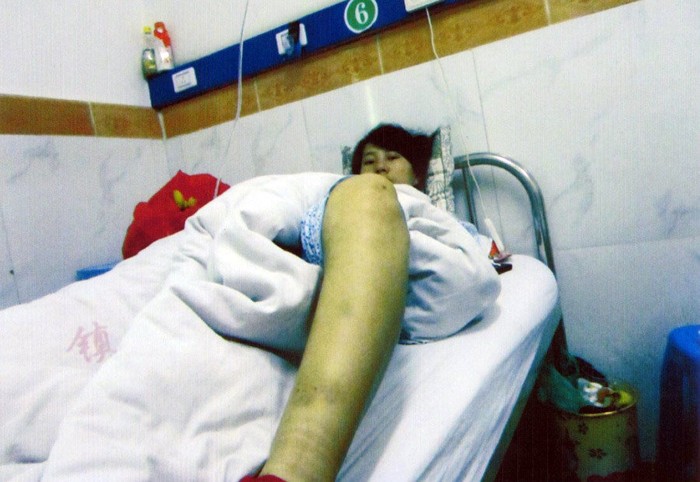 Chị Phùng Kiến Mai sau khi bị cưỡng chế phá thai đã 7 tháng tuổi