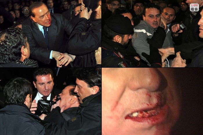 Ngày 13/12/2009, Thủ tướng Ý Silvio Berlusconi vừa bước ra khỏi cuộc họp chính đảng thì bị một người đàn ông cầm dị vật đánh thẳng vào mặt khiến Thủ tướng Ý rơi 2 răng giả, dập xương mũi