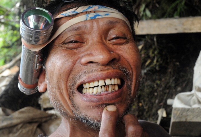 Một người Philippines khoe chiếc răng vàng