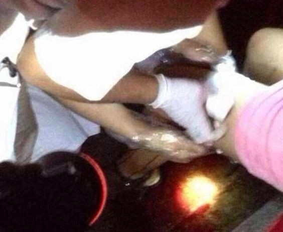 Một nạn nhân bị gã đàn ông bệnh hoạn rạch đùi bằng dao lam tại Phúc Châu, Phúc Kiến, Trung Quốc.