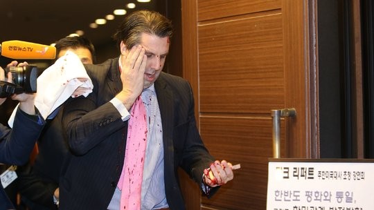 Đại sứ Mỹ tại Hàn Quốc Mark Lippert bị tấn công.