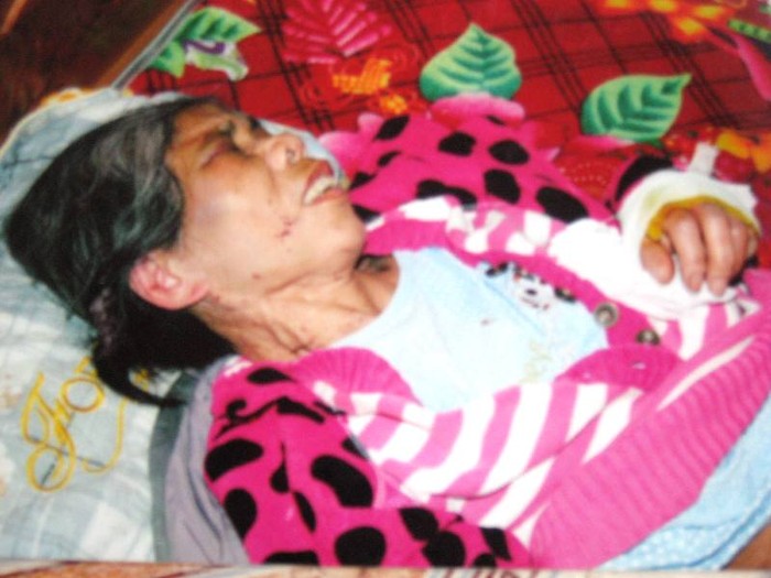 Bà Phương đi làm ô sin bị đánh đập nhiều ngày và bị bỏng 18%