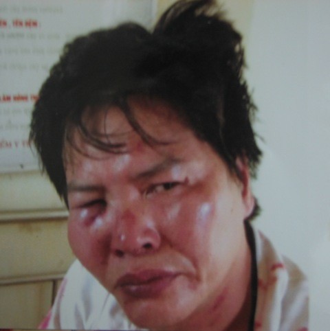 Hình ảnh ông Quang chụp lại hôm xảy ra sự việc ngày 19/6/2011