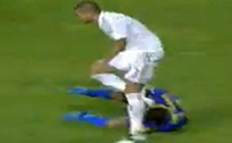 Bị Pepe chơi bẩn, cầu thủ Levante đả kích thầy trò Mourinho ảnh 1