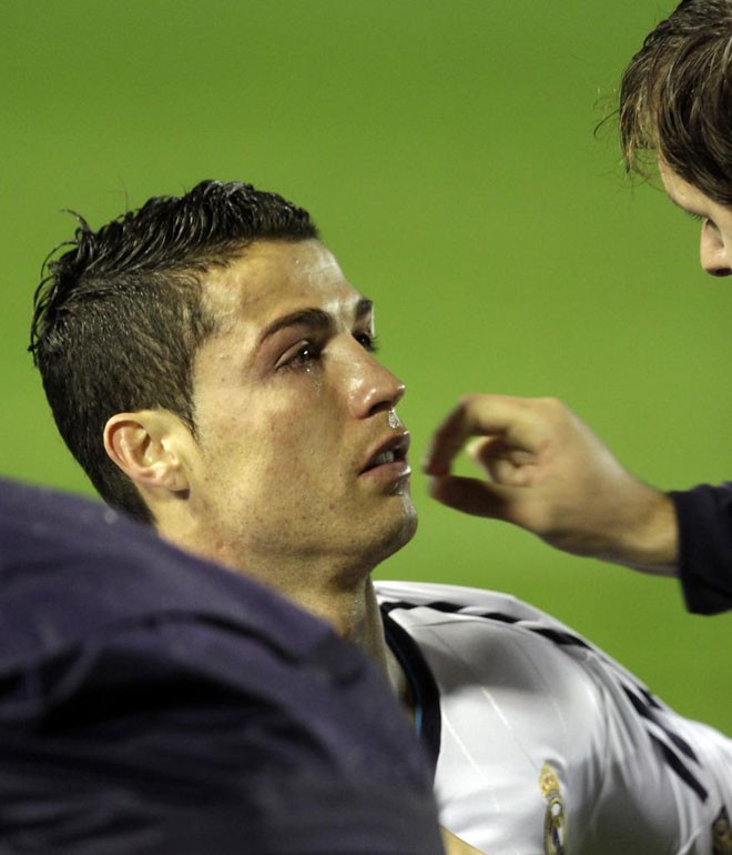 Ronaldo dính chấn thương ở mắt.
