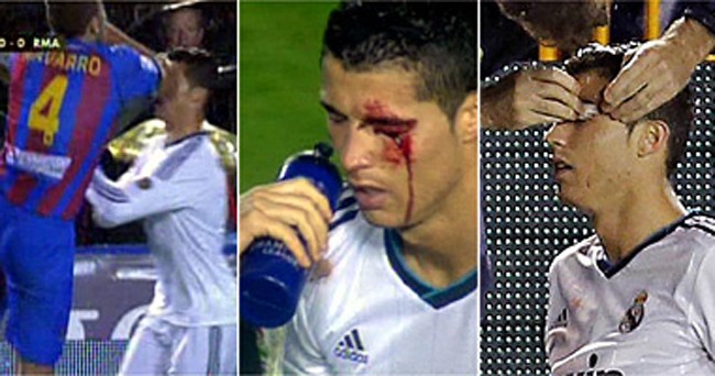 Cận cảnh chấn thương của Ronaldo.