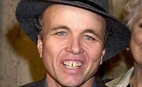 Clint Howard không nghĩ đến việc cải thiện hàm răng, vì anh biết rằng, có cải thiện thì độ đẹp trai cũng chẳng hơn được bao nhiêu. Xem thêm: Choáng váng - hàng loạt hoa hậu hóa "em chã".