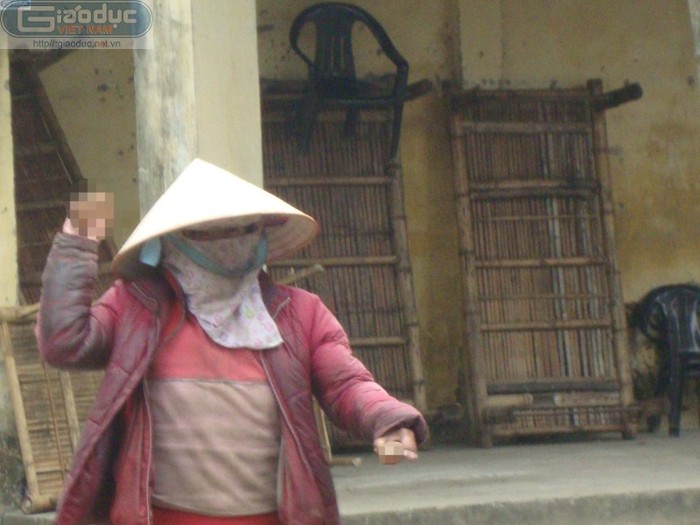 Mang thân hình giống tượng, bà Nguyễn Thị Dính thường xuyên mang găng tay, tất chân, khăn bịt mặt để che đi những phần khiếm khuyết của cơ thể.