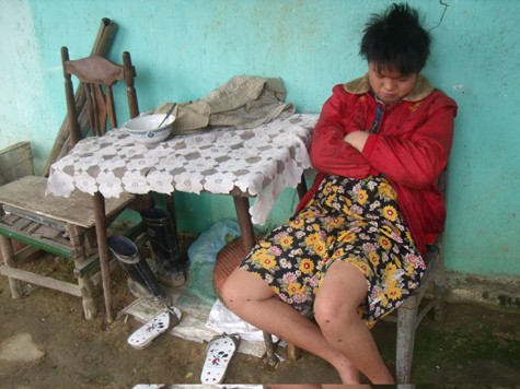 Em Nguyễn Thị Thanh Nga (em gái Nhạn), đang mắc chứng bệnh tâm thần