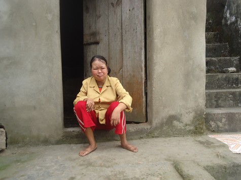 Chị Trịnh Thị Cúc bị ảnh hưởng chất độc da cam