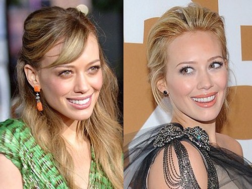 Hilary Duff đã thẩm mỹ bộ răng của mình và dĩ nhiên nó đều đặn và đẹp hơn hẳn. Xem thêm: Ngắm Sao Việt thuở còn..."răng sữa"/Scarlett Johansson "mất điểm" vì hàm răng ố vàng và mập ú/Thảm họa thẩm mỹ của Sao
