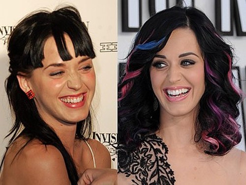Katy Perry có hàm răng trắng sáng hơn xưa rất nhiều. Xem thêm: Ngắm Sao Việt thuở còn..."răng sữa"/Scarlett Johansson "mất điểm" vì hàm răng ố vàng và mập ú/Thảm họa thẩm mỹ của Sao