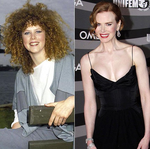 Xuất hiện trên màn ảnh nhỏ từ năm 1983, khi ấy Nicole Kidman chỉ 15 tuổi. Với nụ cười trẻ trung làm mê hoặc lòng người, gương mặt Nicole vẫn căng mịn, dù đã 45 tuổi. Xem thêm: Sao Hoa ngữ/Sao Việt/Sao Hàn/Sao Hollywood