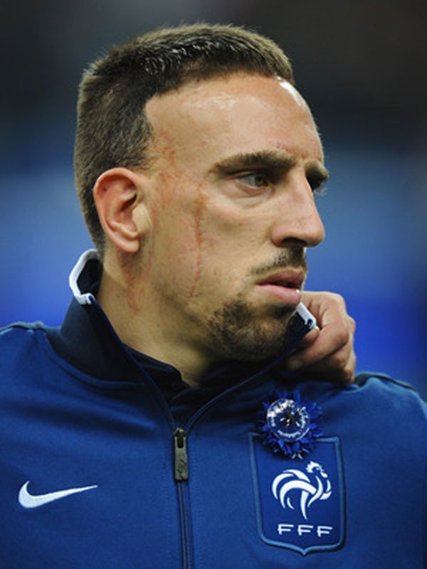 Tiền vệ phải: Franck Ribery - một trong những nhân chứng của cuộc điều tra mà cảnh sát Pháp thực hiện với đường dây cung cấp gái mại dâm vị thành niên