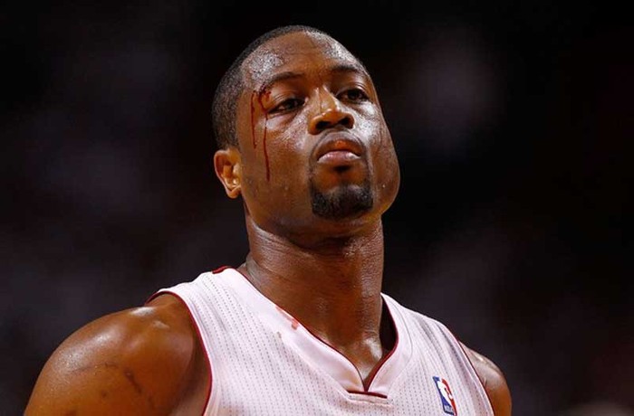 Hậu vệ Dwyane Wade của Miami Heat đổ máu sau một pha đánh cùi chỏ của một cầu thủ đội Indiana Pacers trong trận thứ 5, vòng bán kết khu vực miền Đông của NBA Playoff 2012.