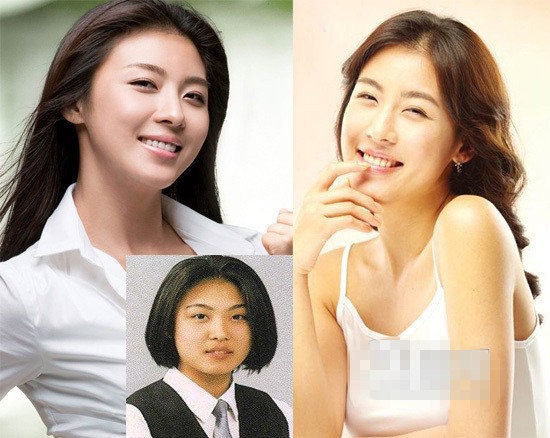 Ha Ji Won liệu có phải là nhờ thẩm mỹ để trở thành mỹ nhân không?