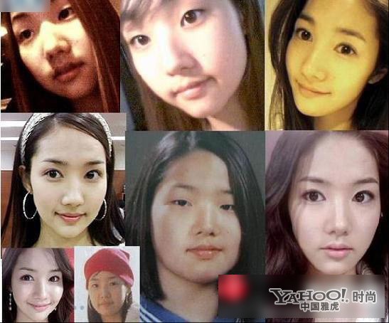 Park Min Young trước và sau khi phẫu thuật quả thật là "vịt" và "thiên nga". Ảnh: Yahoo