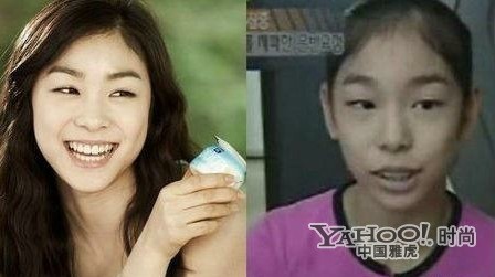 Kim Yuna, thiên thần trượt băng nghệ thuật của Hàn Quốc, siêu sao quảng cáo cũng đã phải nhờ tới dao kéo. Ảnh: Yahoo