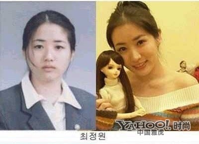 Choi Jung Won, cô em ba xinh đẹp của "những nàng công chúa nổi tiếng" đã cuốn hút bao người bởi vẻ ngoài xinh xắn, nhưng đó lại là sản phẩm của thẩm mỹ hiện đại. Ảnh: Yahoo