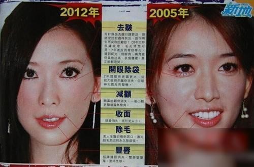 Những nét biến đổi trên khuôn mặt của người đẹp khiến cho tin đồn phẫu thuật càng thêm lan rộng.