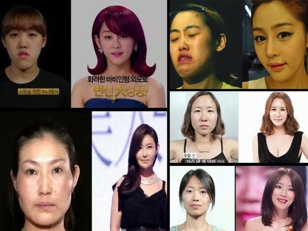 Nổi tiếng với công nghệ thẩm mỹ, Hàn Quốc đất nước được mệnh danh là người đẹp của dao kéo, có thể biến "vịt" thành "hot girl", già thành trẻ.