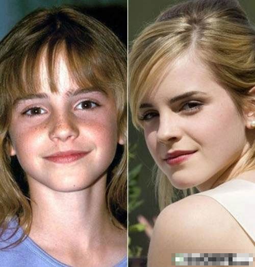 Cô phù thủy nhỏ xinh đẹp Hermione ngày nào giờ đã lớn, trở thành một trong những bông hồng tài sắc nhất nước Anh. Ngắm hình có thể nhận thấy, Emma đã cho những đốm tàn nhang xấu xí "bay" sạch.
