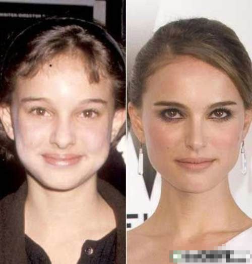 "Thiên nga đen" Natalie Portman khi còn là một thiếu nữ có gương mặt bầu bĩnh hơn bây giờ.
