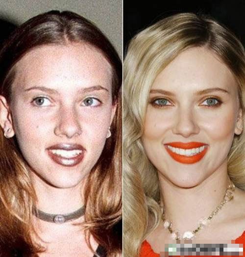 Trước khi là một nữ diễn viên nổi tiếng, Scarlett Johansson đã từng được mời làm người mẫu cho các hãng thời trang mang phong cách gợi cảm. Lúc đó, gương mặt đẹp của cô được ngợi khen khá nhiều. Nhưng, nếu so với Scarlett của hiện tại, rõ ràng Scarlett trước kia "quê" hơn, kém rạng rỡ hơn hẳn.